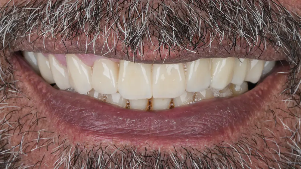 dr-saleh-6-after.webp