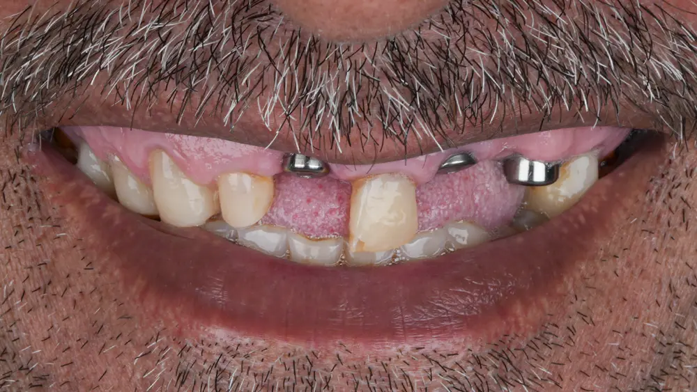 Before Image