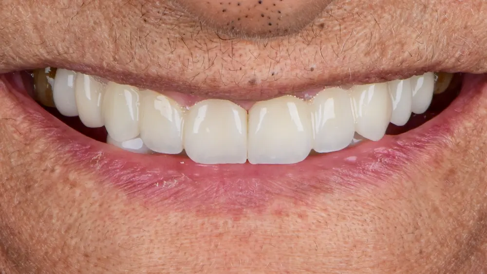 dr-saleh-7-after.webp