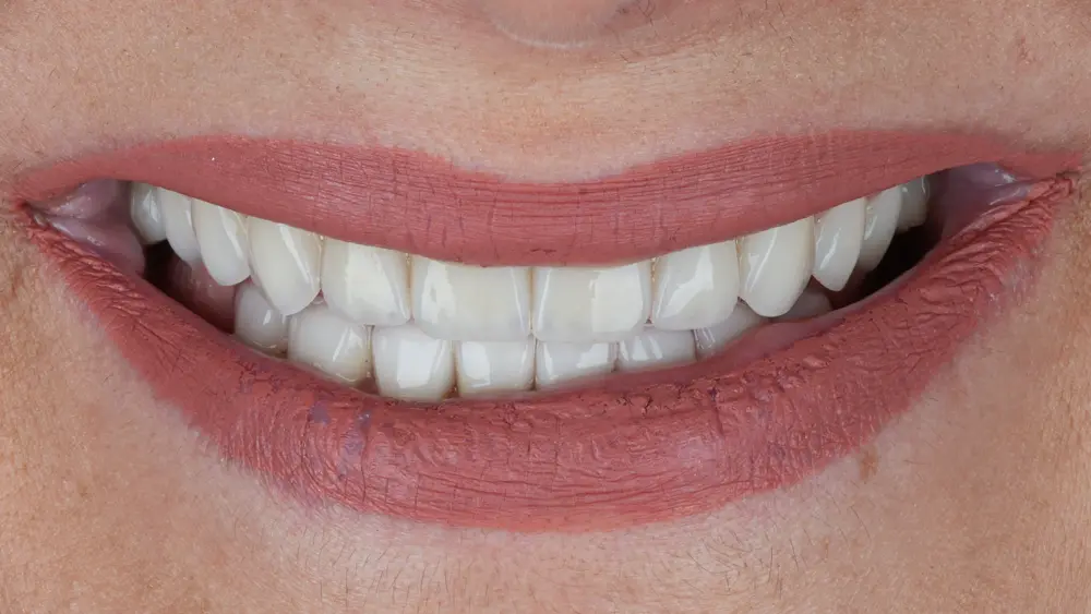 dr-saleh-8-after.webp