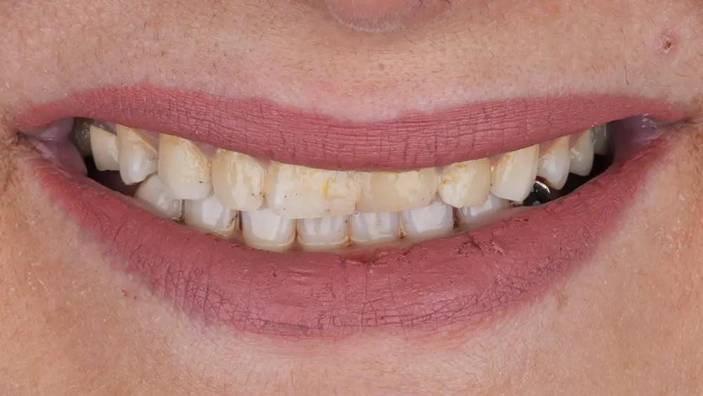 Before Image
