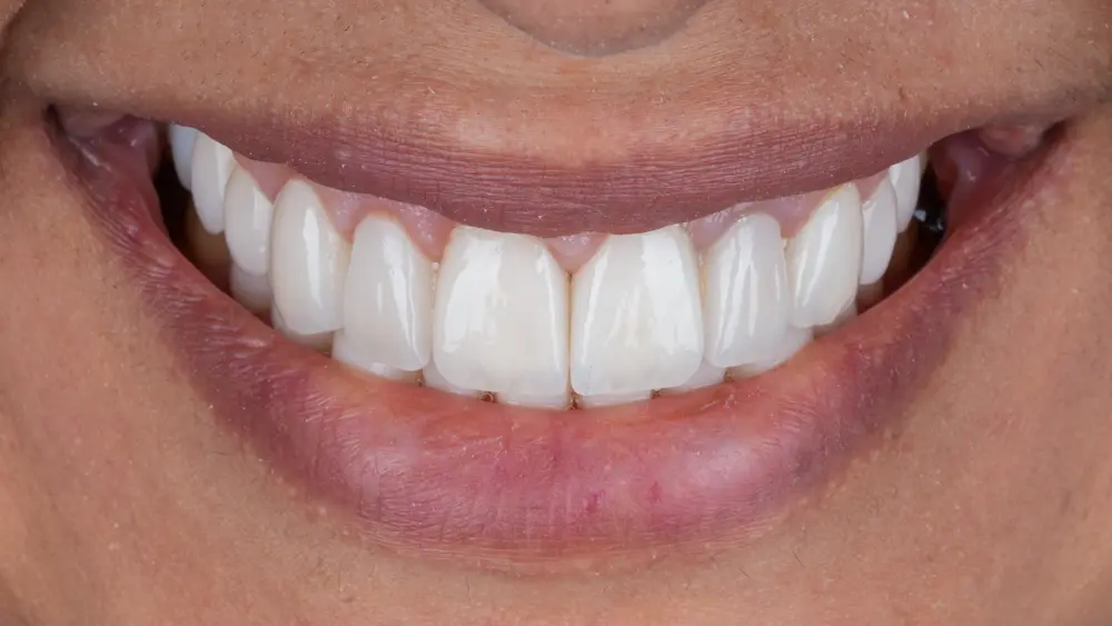 dr-saleh-9-after.webp