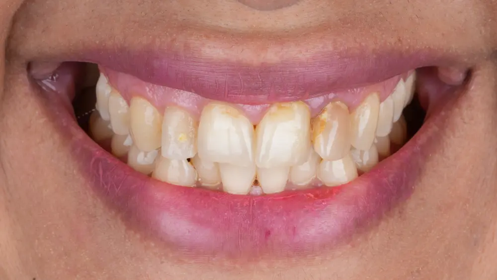 Before Image