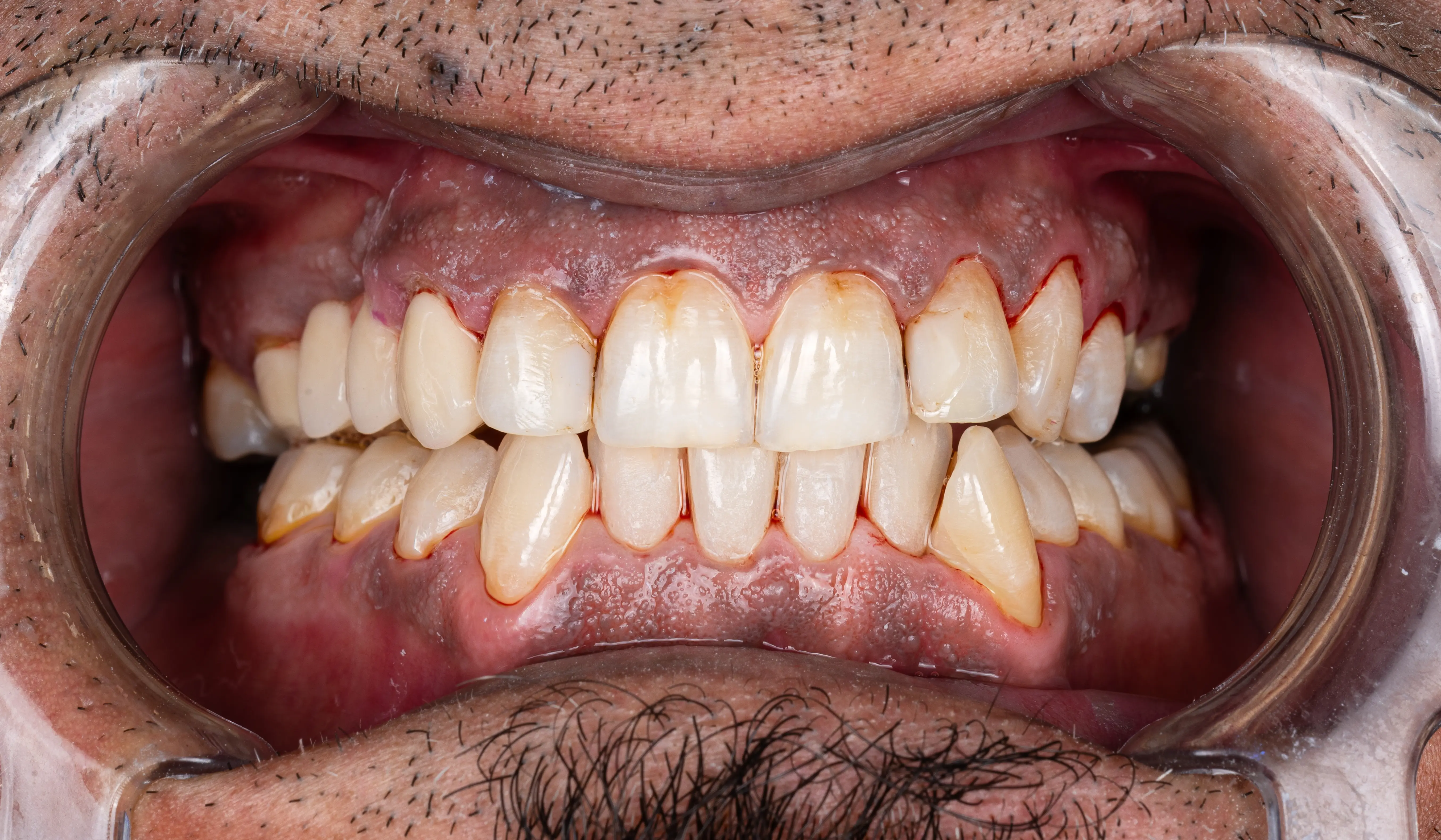 dr-shadan-1-after.webp