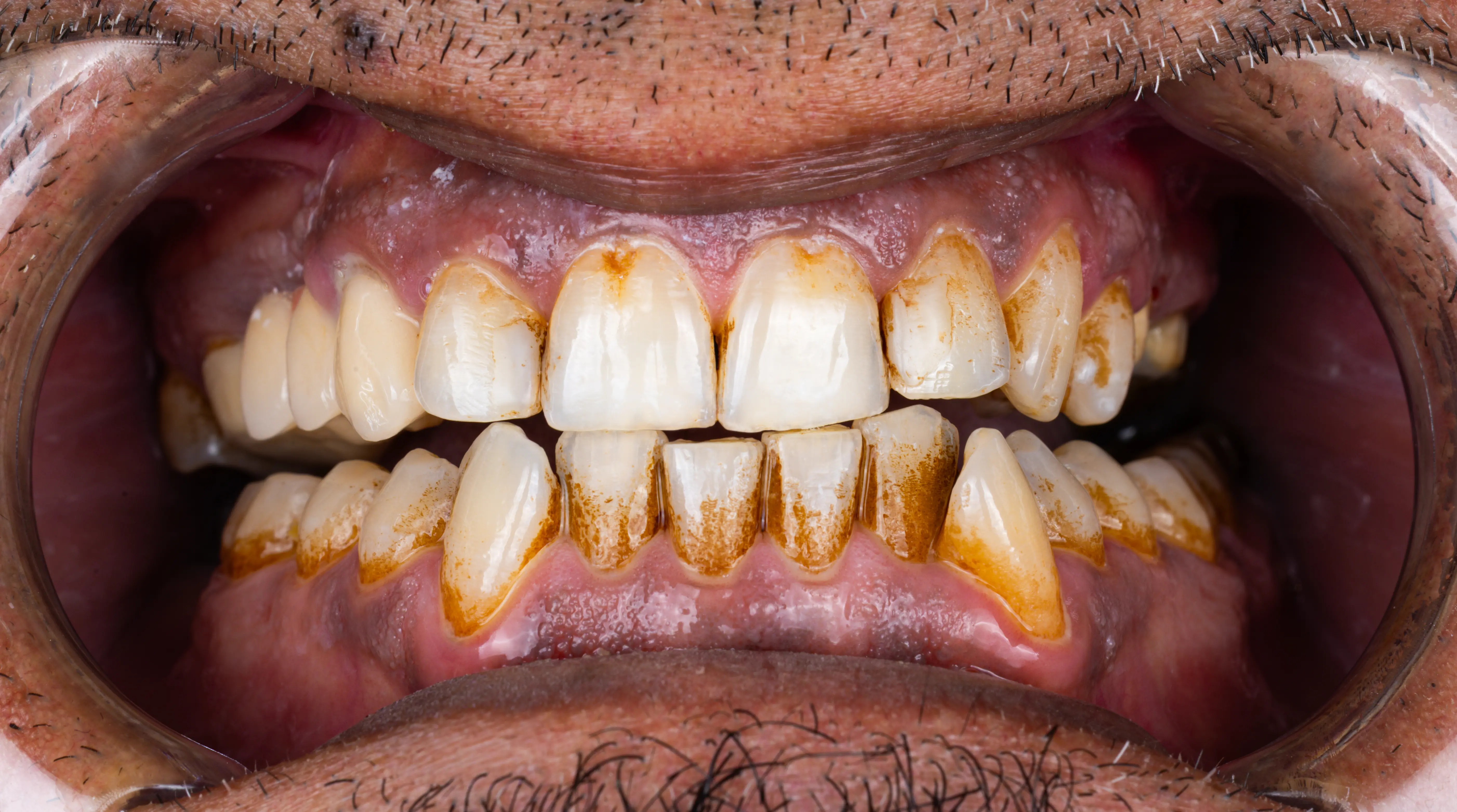 Before Image