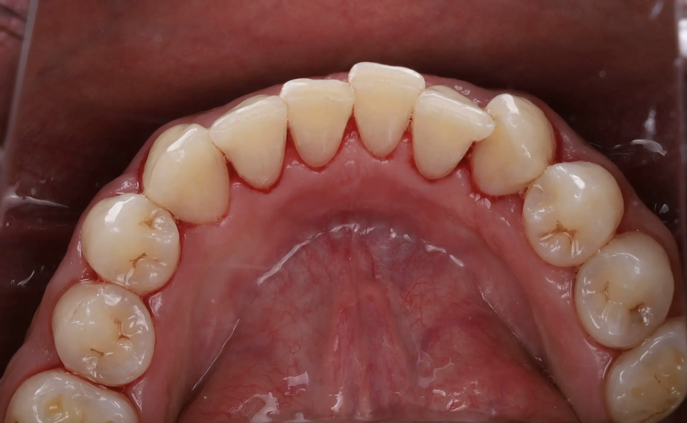 dr-shadan-2-after.webp