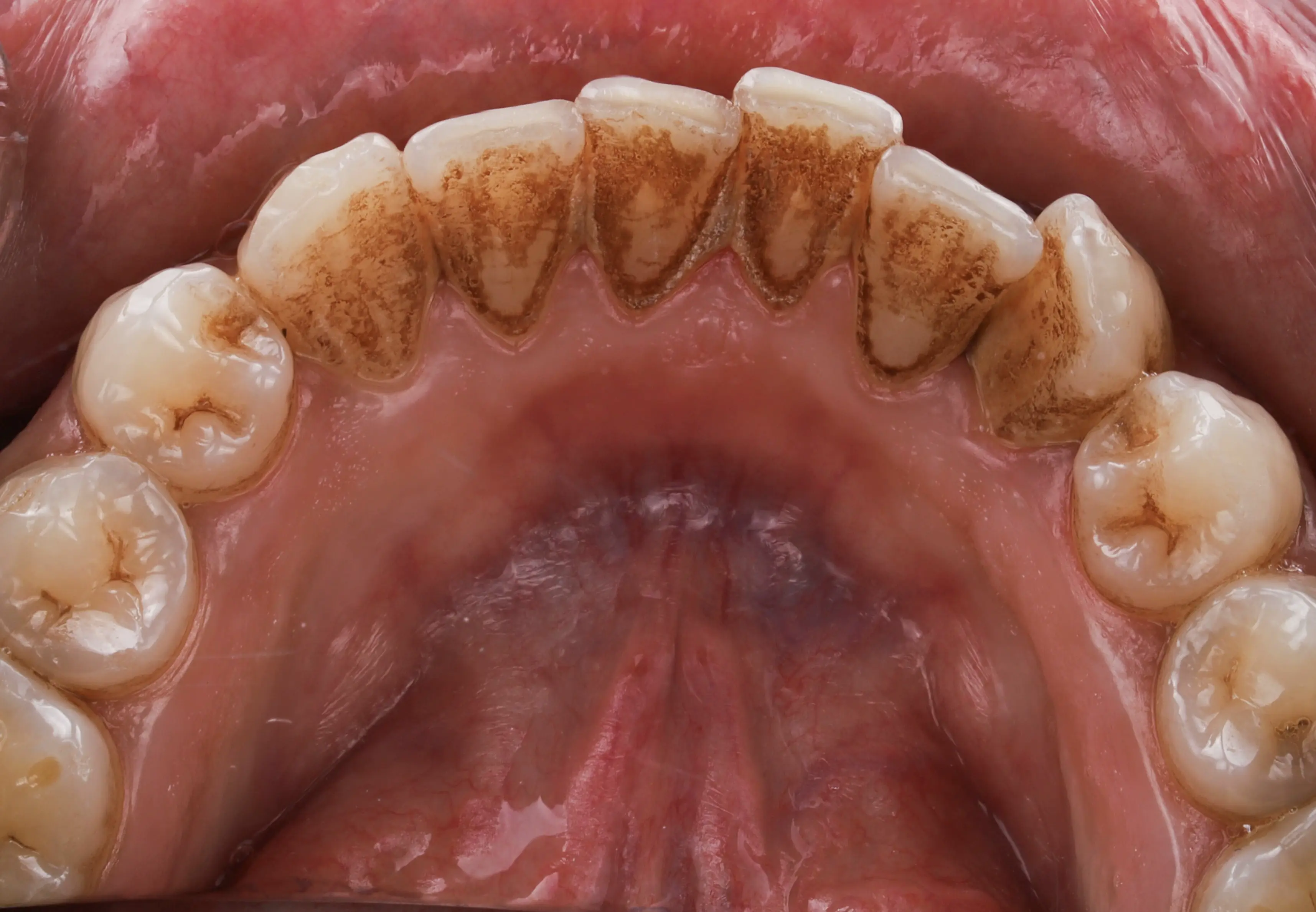 Before Image