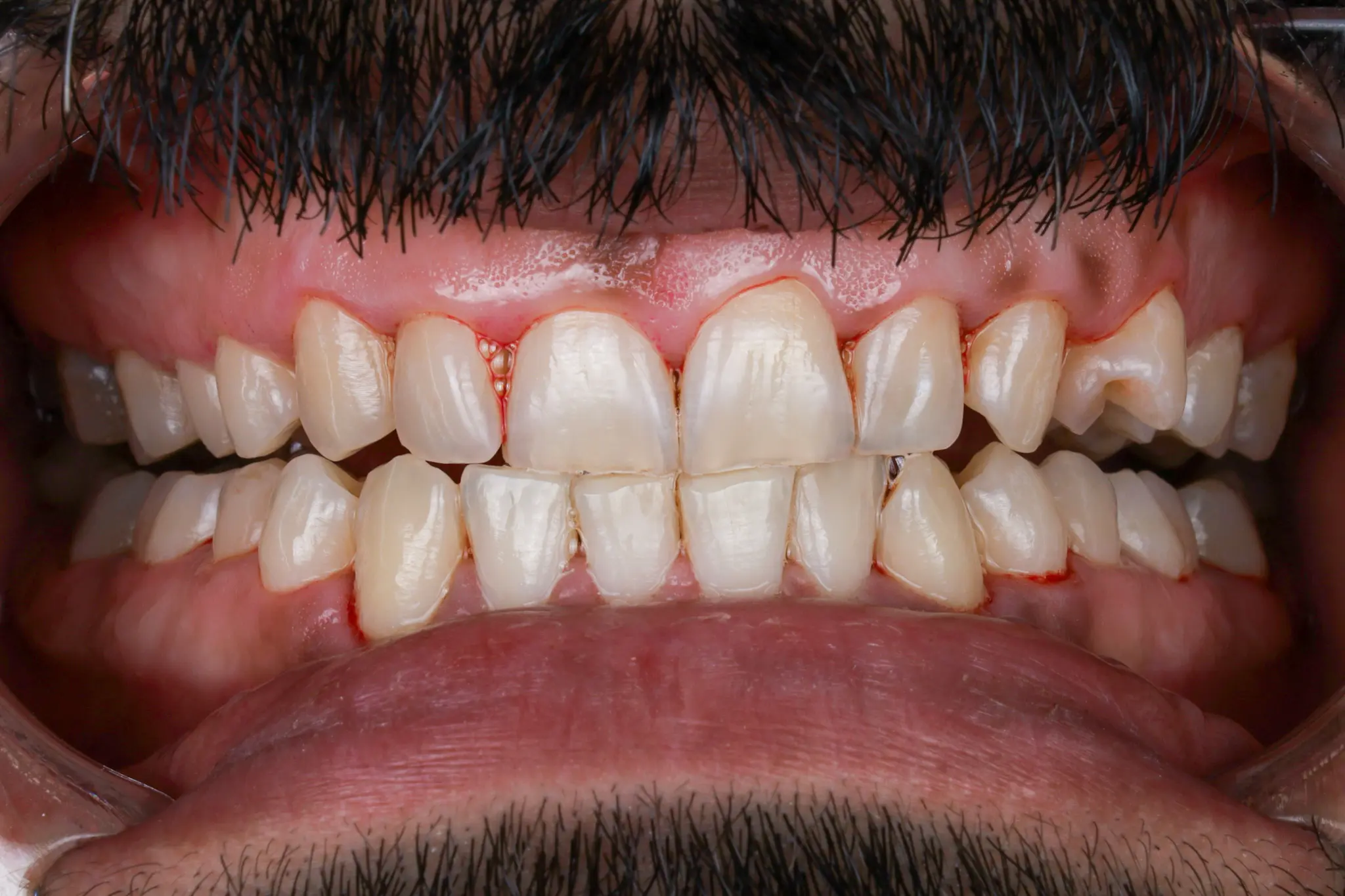 dr-shadan-3-after.webp