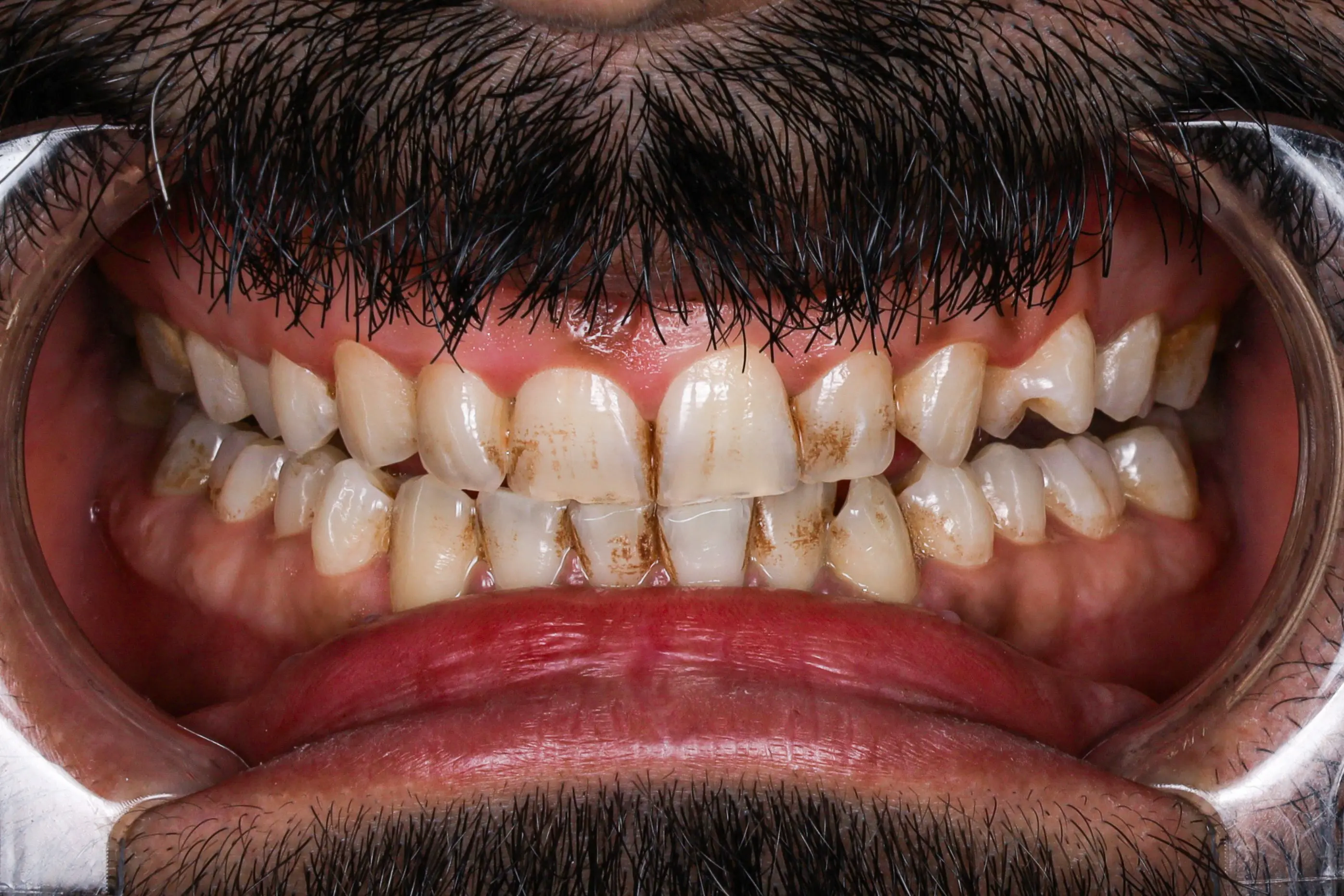 Before Image