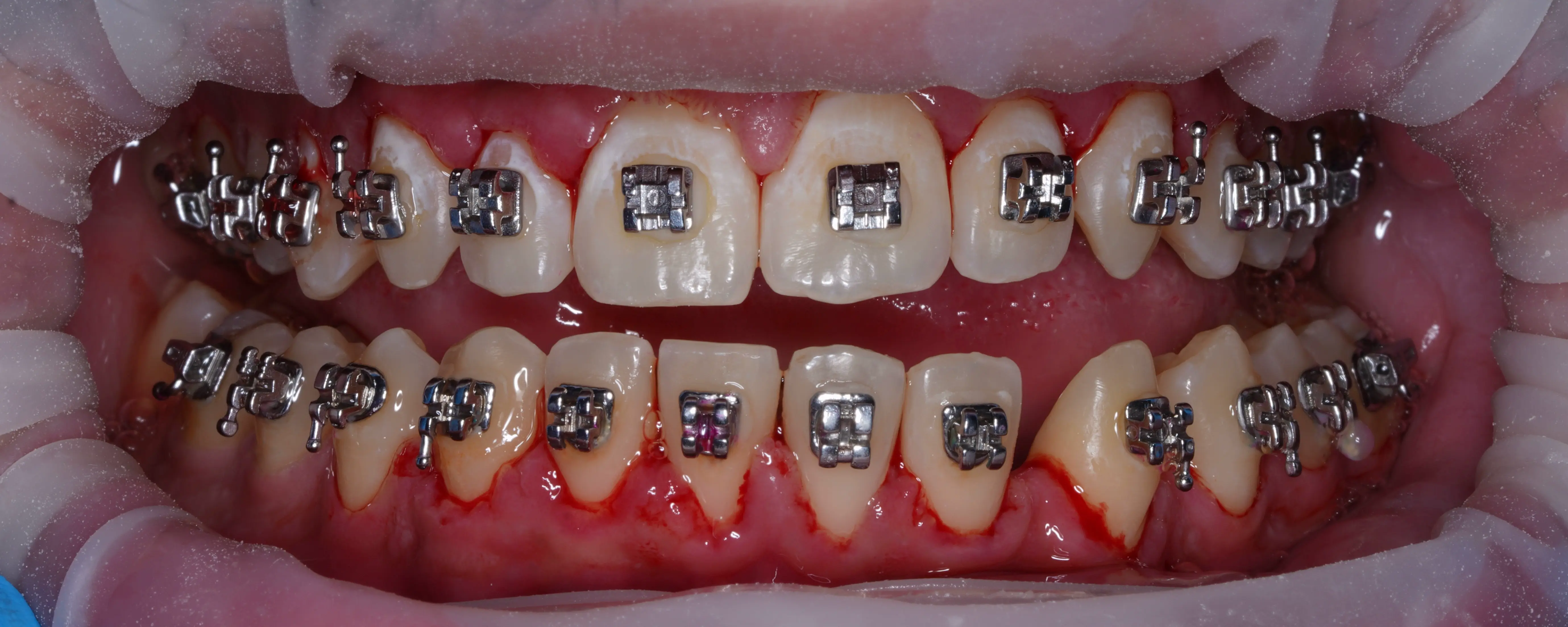 dr-shadan-4-after.webp