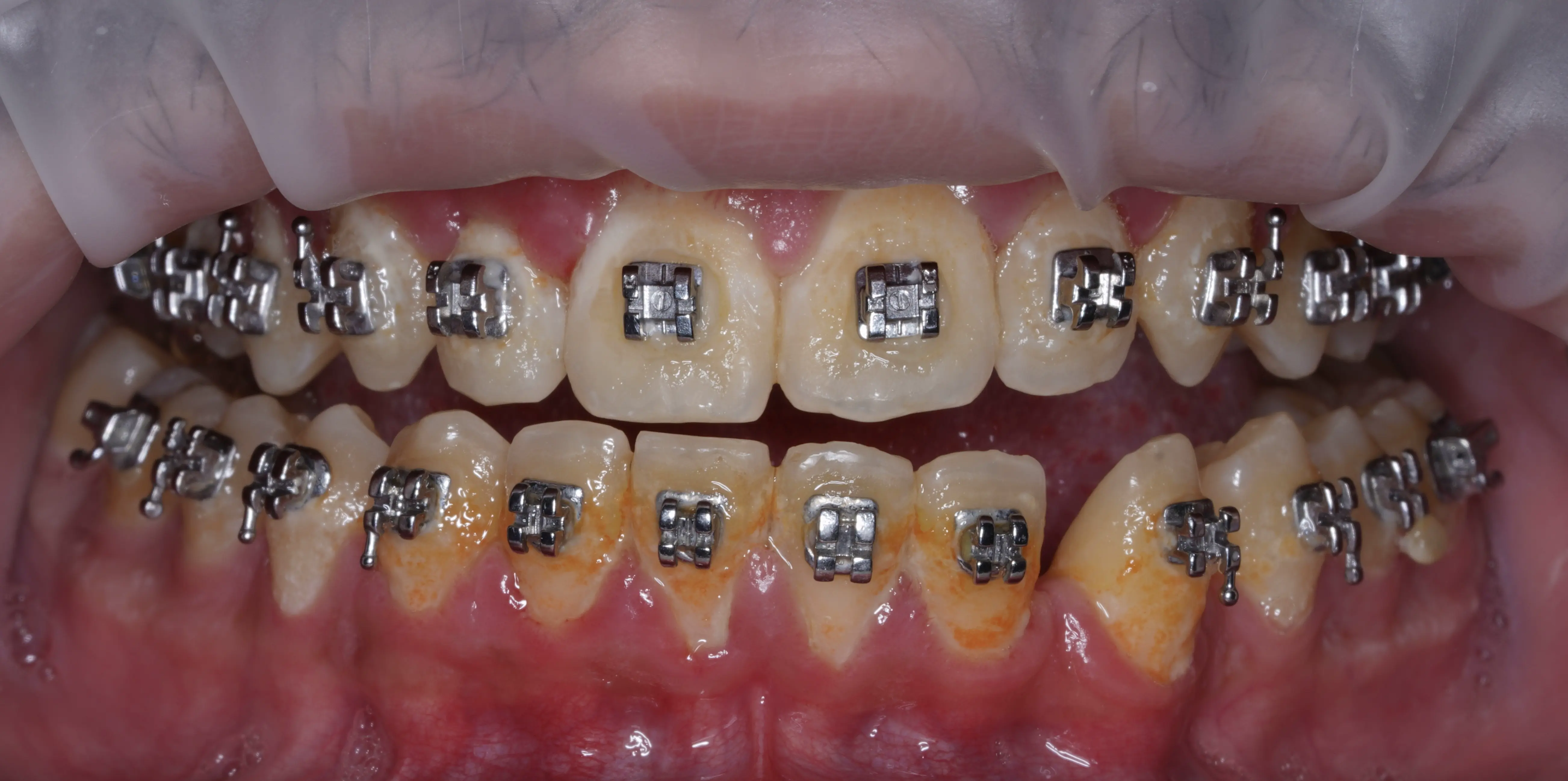Before Image