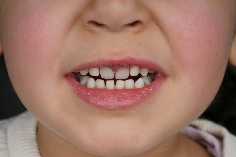 dr-tamara-1-after.webp