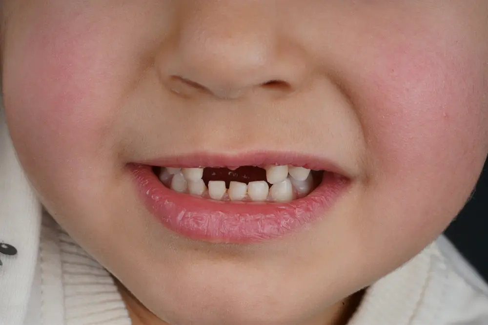 Before Image