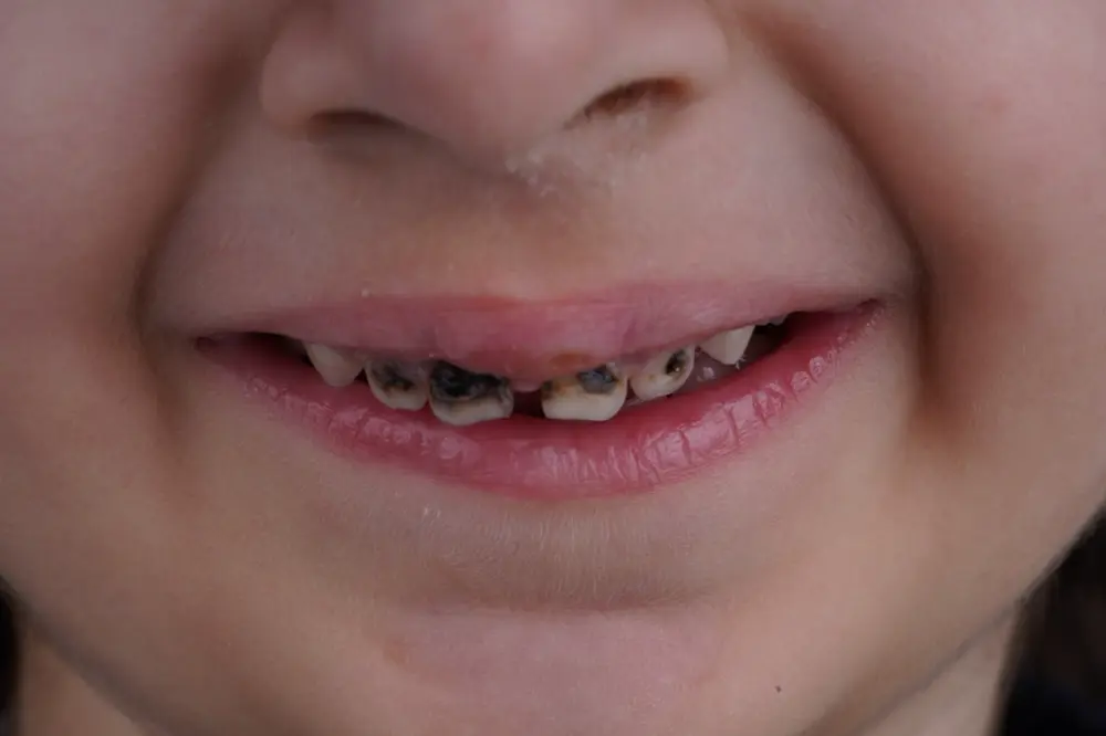 Before Image