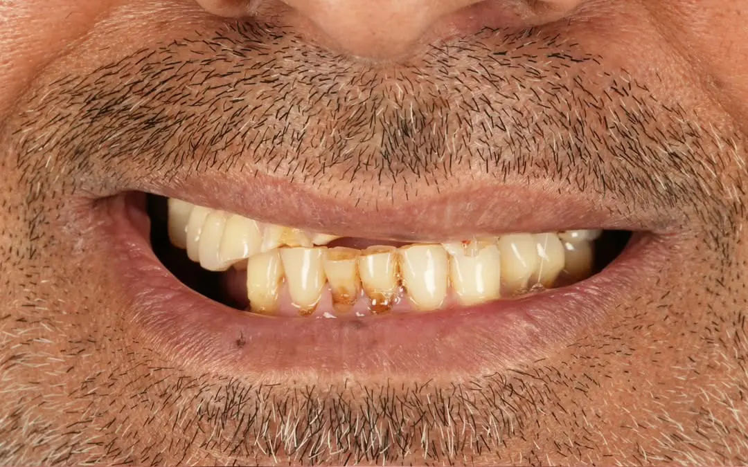 Before Image