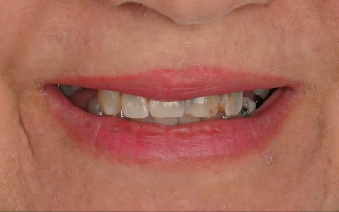 Before Image