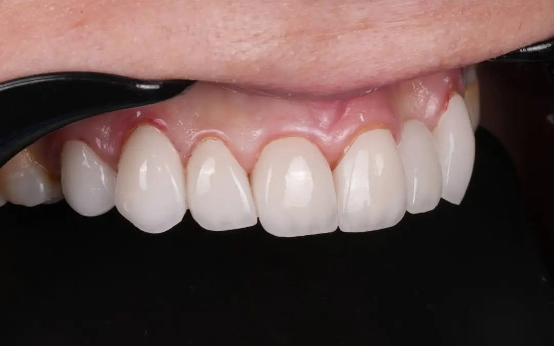 After Image