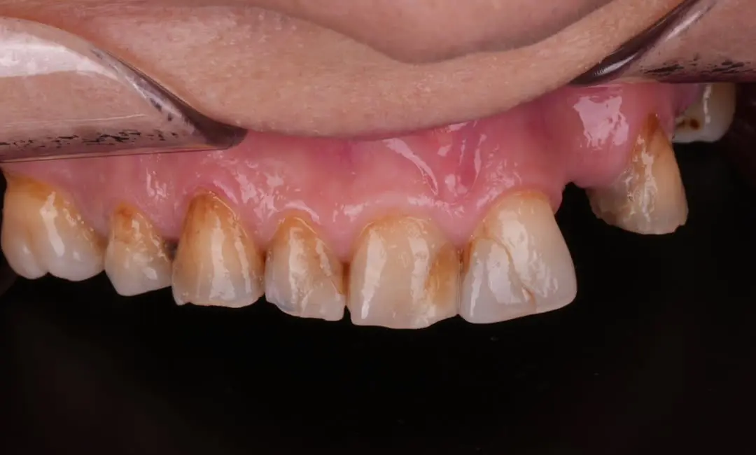 Before Image