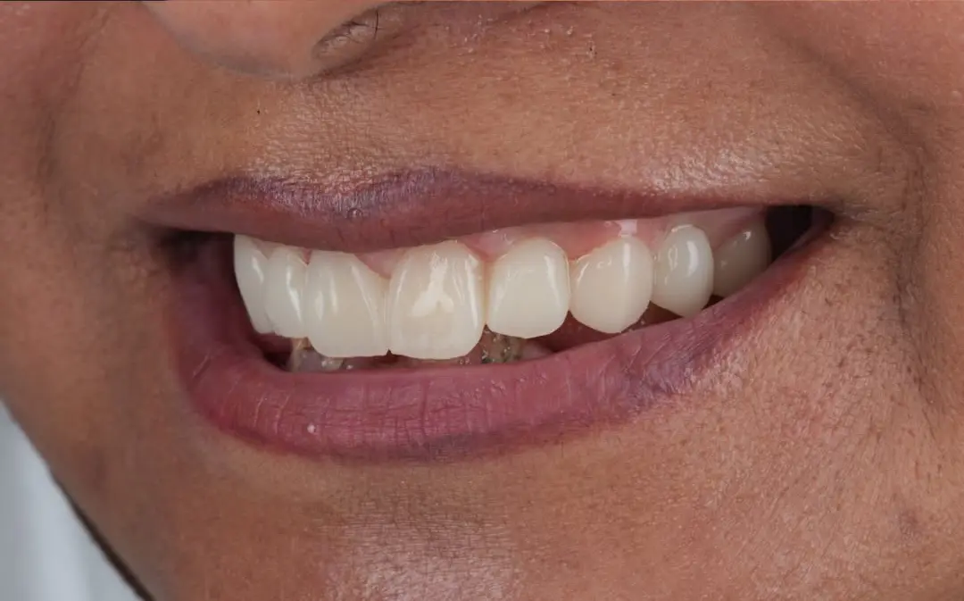 After Image