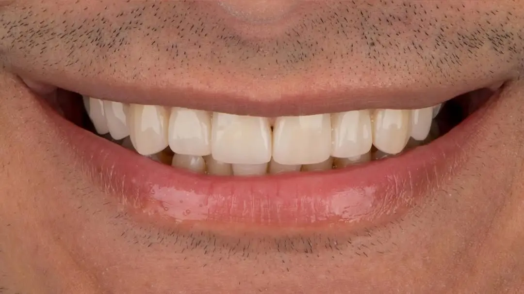 After Image