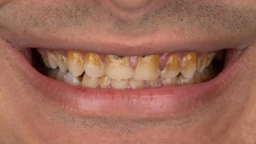 Before Image
