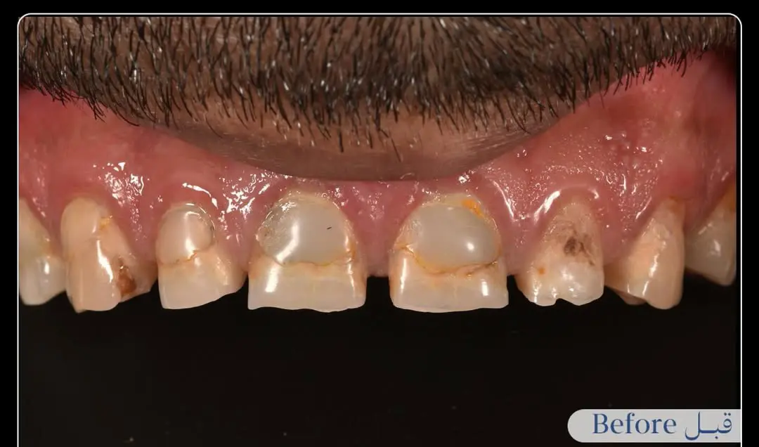 Before Image