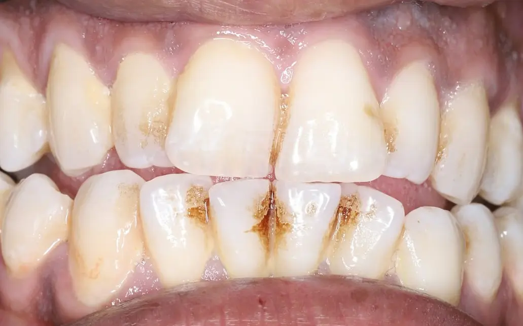 Before Image