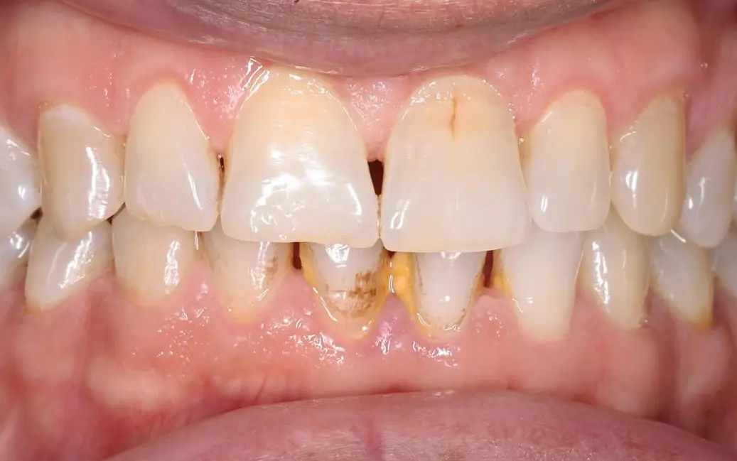Before Image