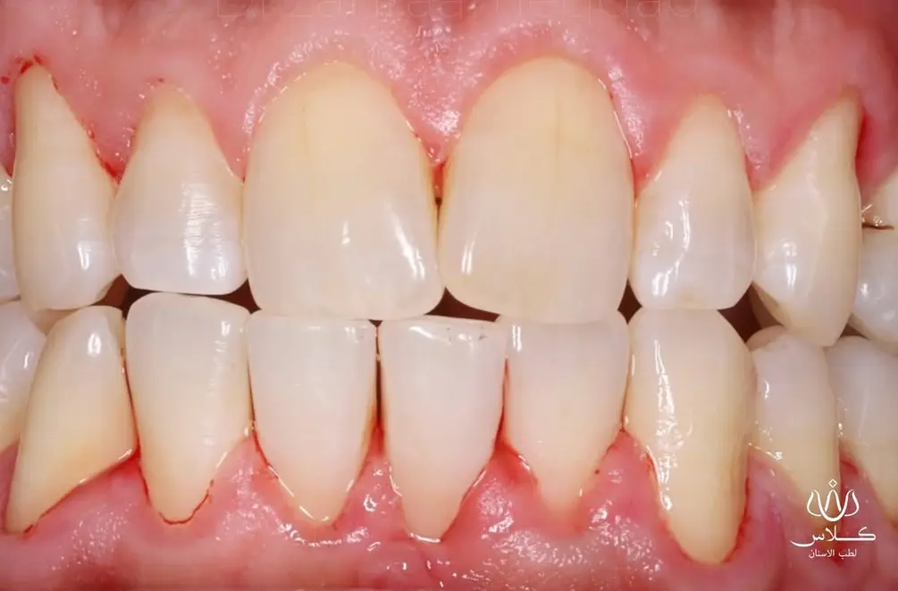 After Image