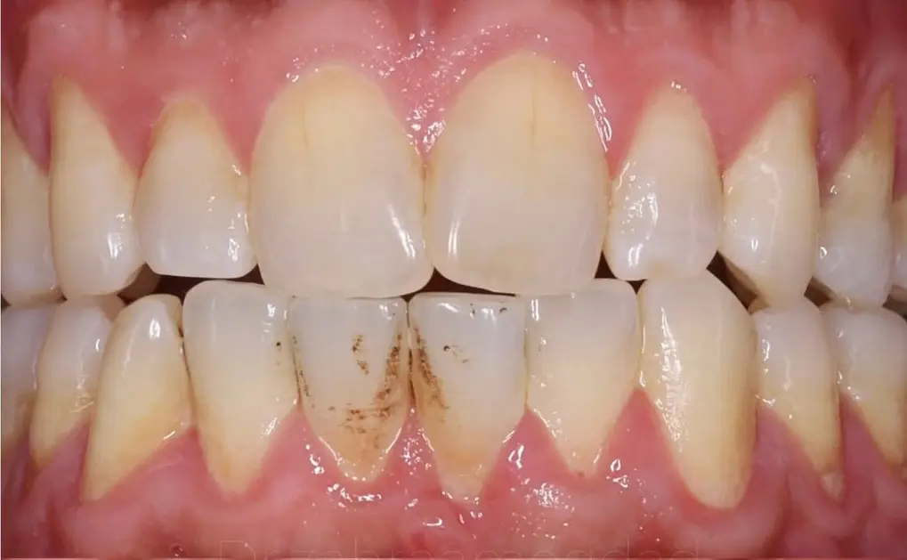 Before Image
