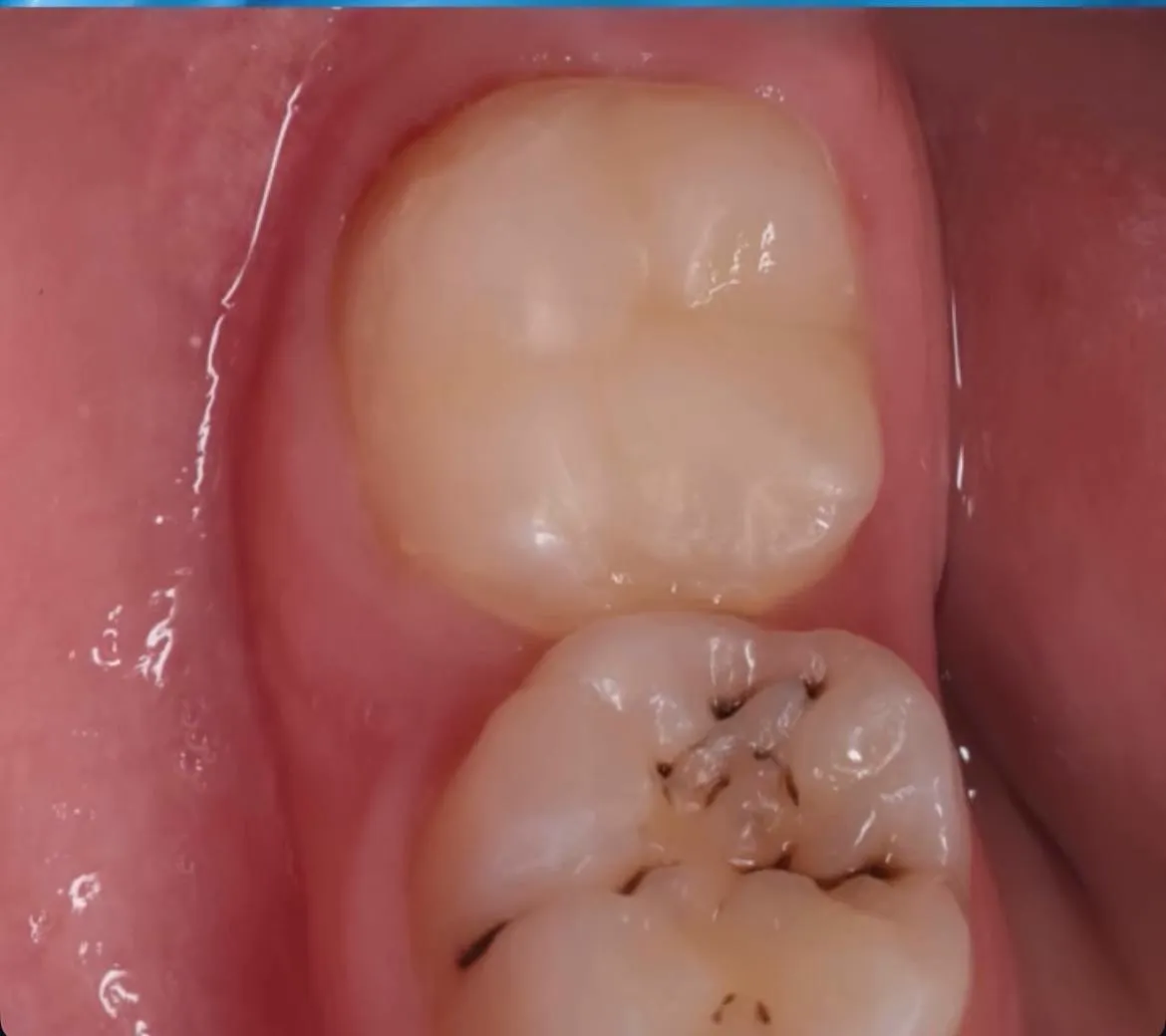 After Image