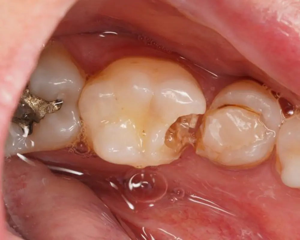 Before Image