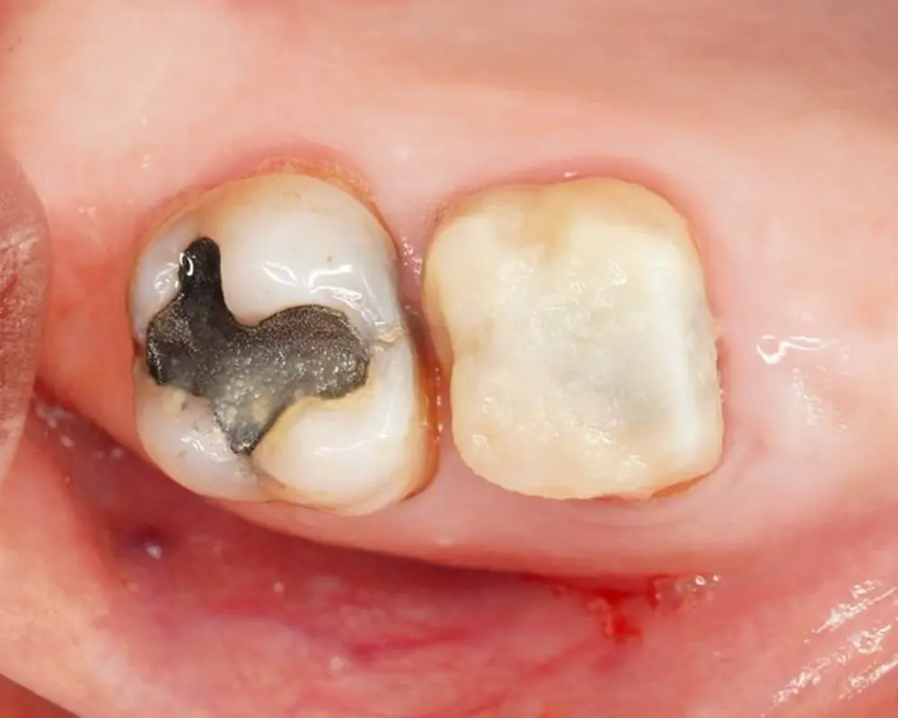Before Image