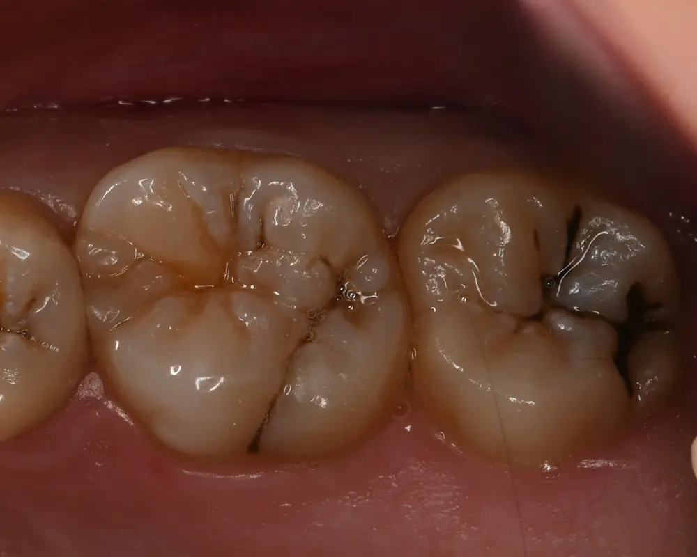 Before Image