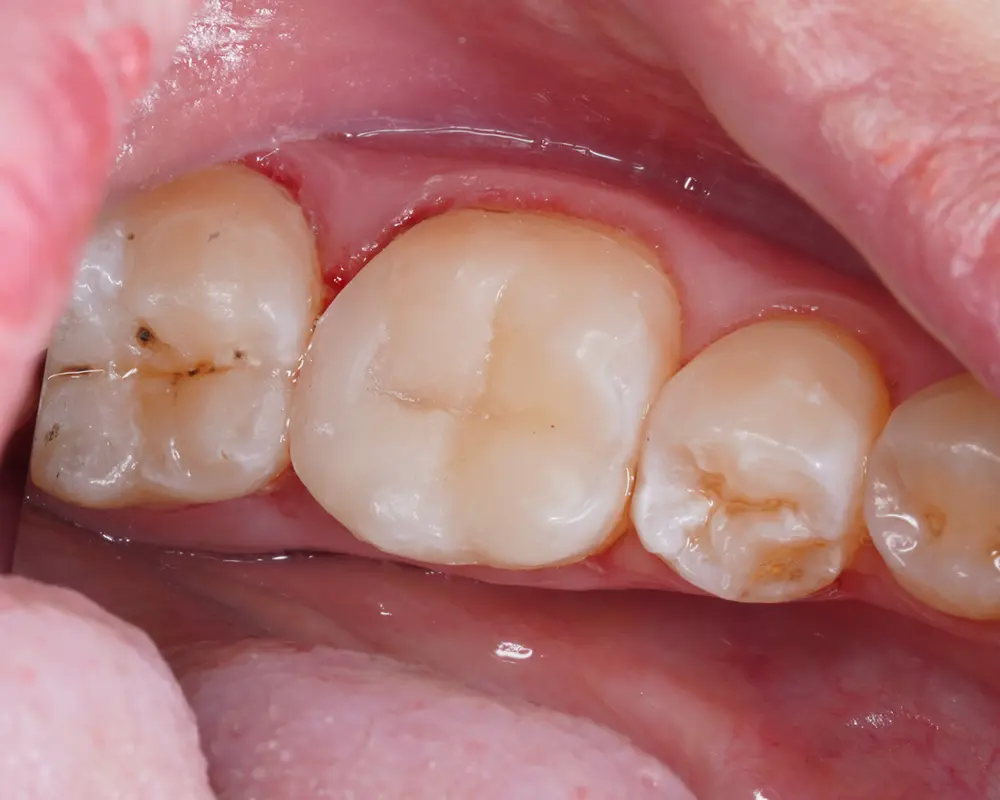 dr-zainab-4-after.webp