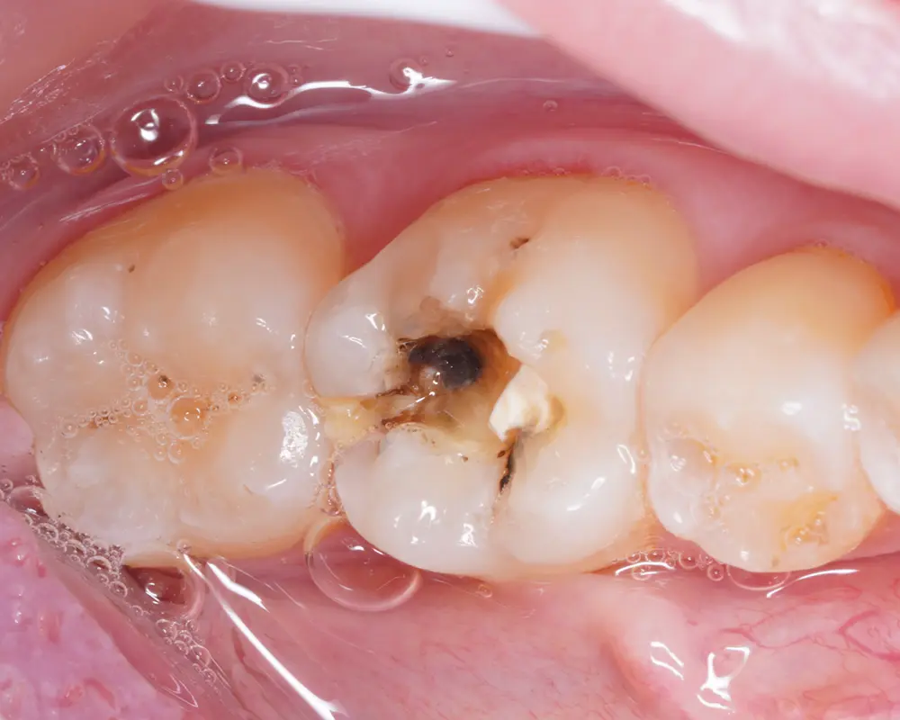Before Image