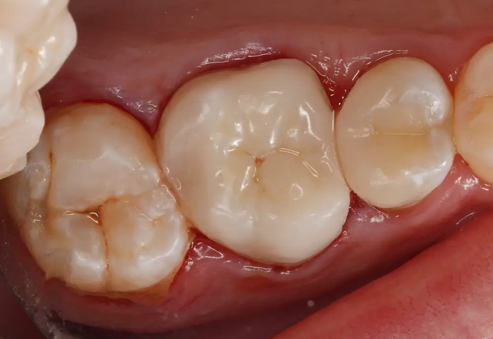 dr-zainab-5-after.webp