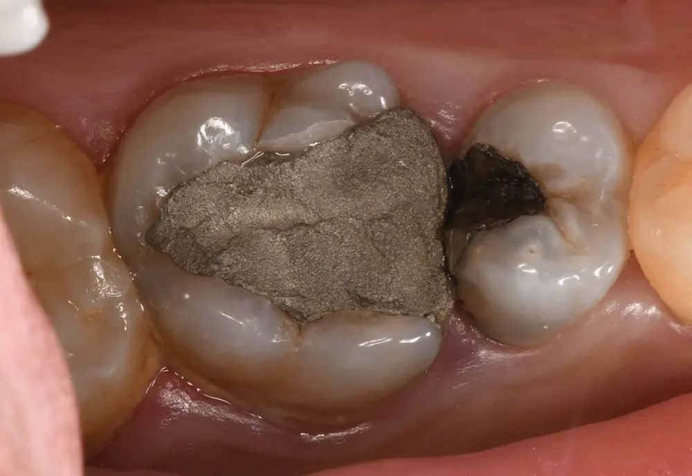 Before Image